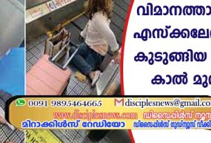 വിമാനത്താവളത്തിലെ എസ്ക്കലേറ്ററില്‍ കാല്‍ കുടുങ്ങിയ സ്ത്രീയുടെ കാല്‍ മുറിച്ചു മാറ്റി