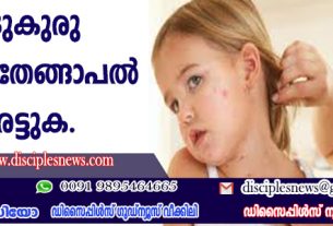 ചുടുകുരു മാറാന്‍ തേങ്ങാപ്പാല്‍ പുരട്ടുക